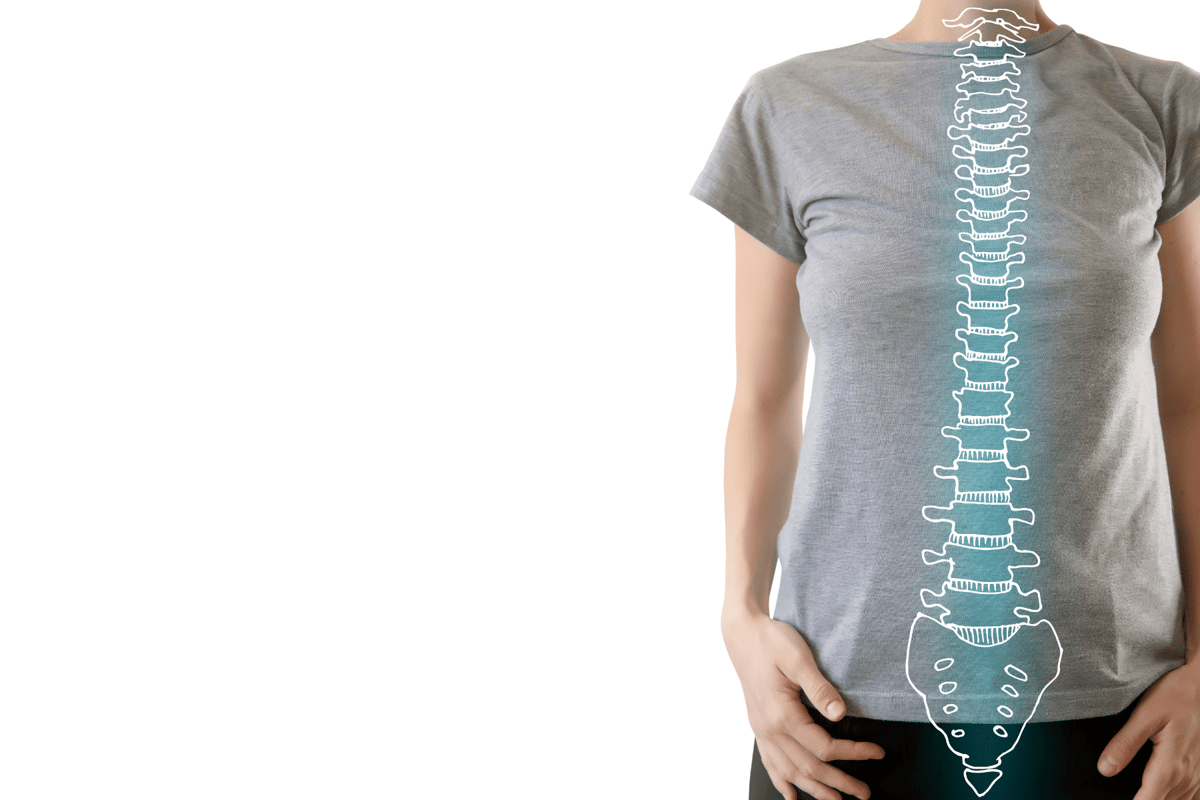 How Should Your Fitness Center be Conducting a Posture Analysis?