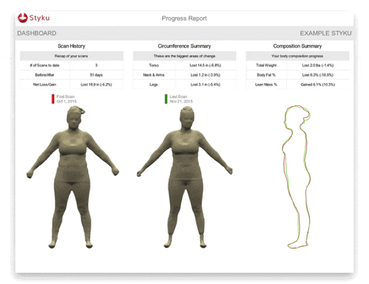 3D Health Screening and Body Composition Technology - Styku