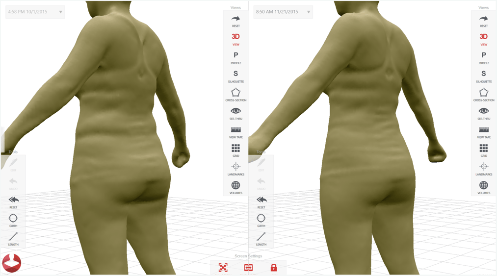 ShapeDifference.png