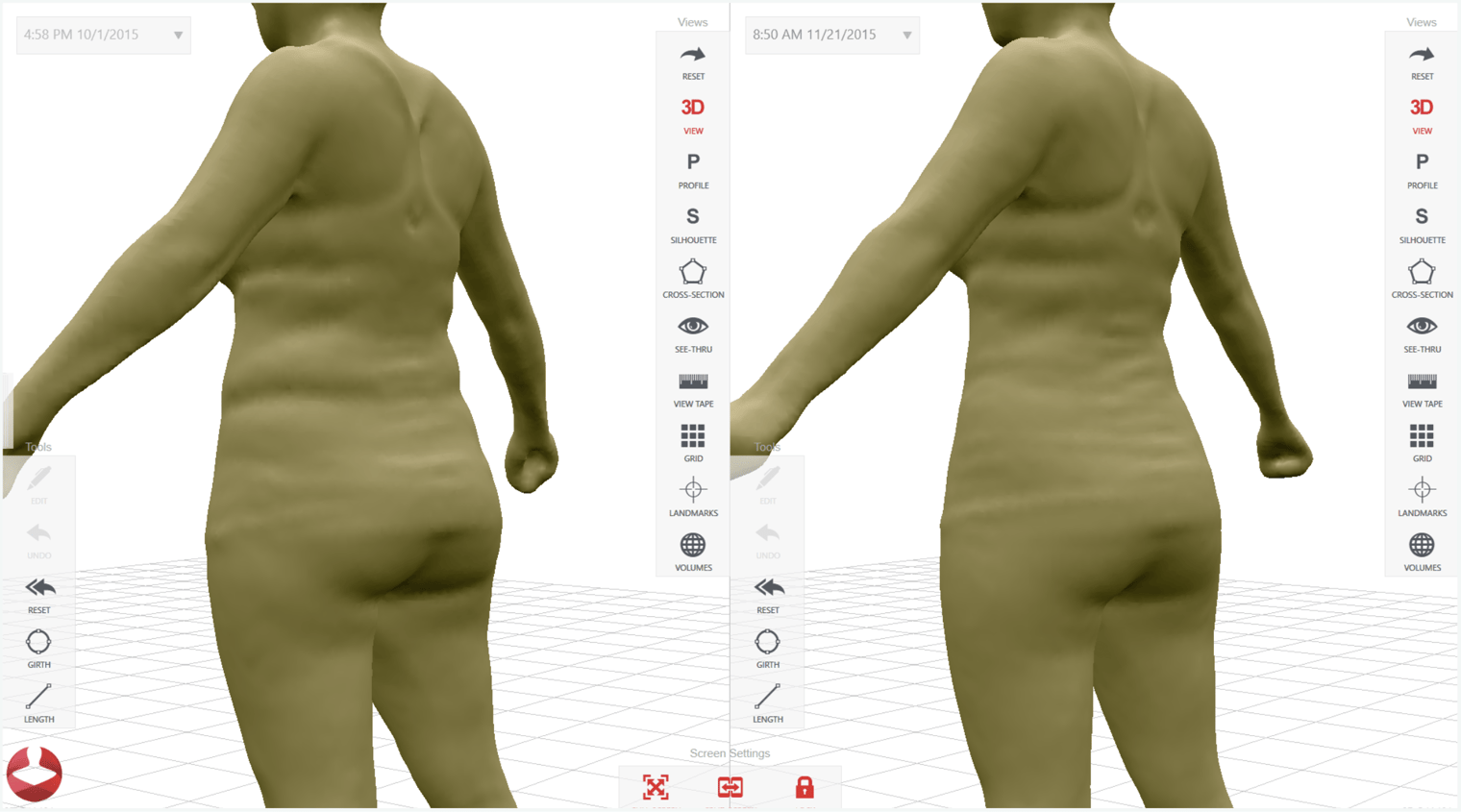 styku-3d-body-scanning-and-shape-analysis-for-fitness-health-apparel